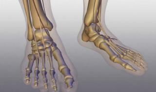 骨癌有什么症状有哪些 骨癌有什么症状有哪些